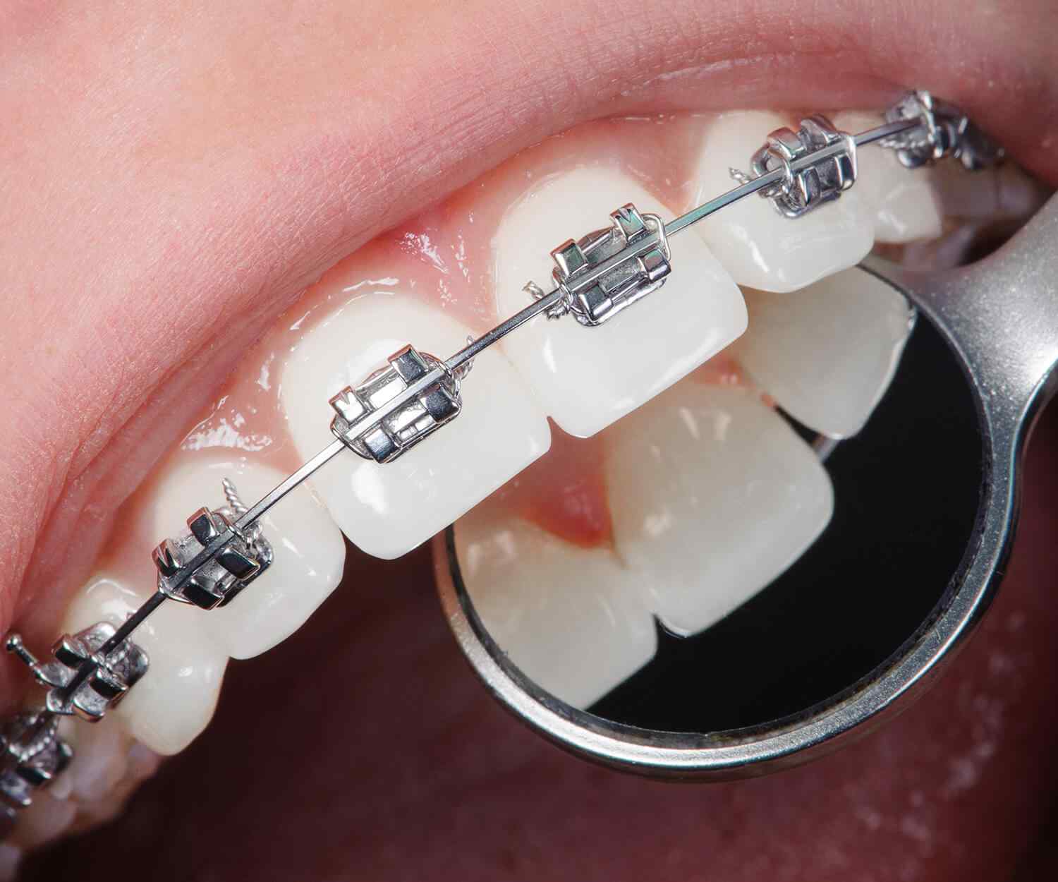 https://drpraneetorthogoa.com/wp-content/uploads/2021/10/card_image_home_03-03.jpg