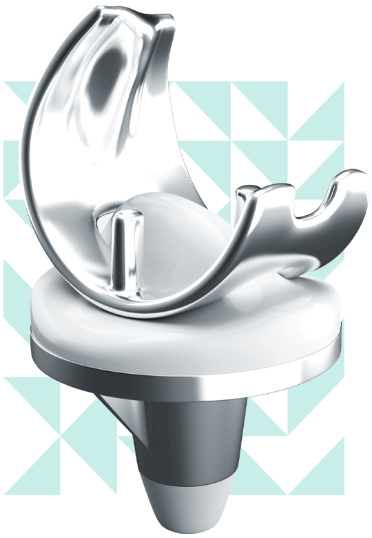 inner_image_home_02 https://drpraneetorthogoa.com/wp-content/uploads/2021/10/inner_image_home_02.gif
