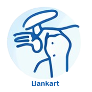 https://drpraneetorthogoa.com/wp-content/uploads/2026/04/Bankartgghhhg.png