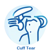 https://drpraneetorthogoa.com/wp-content/uploads/2026/04/Cuff-Tear-123.png