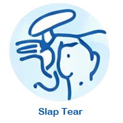 https://drpraneetorthogoa.com/wp-content/uploads/2026/04/Slap-Tear-2.png