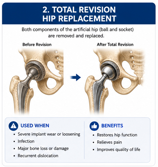 https://drpraneetorthogoa.com/wp-content/uploads/2026/05/2-Total-Revision.jpg