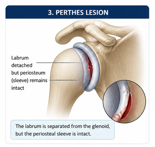 https://drpraneetorthogoa.com/wp-content/uploads/2026/05/Perthes.jpg