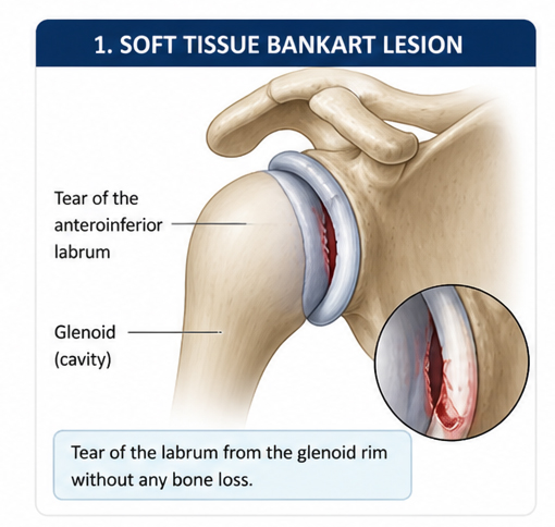 https://drpraneetorthogoa.com/wp-content/uploads/2026/05/soft-tissue.jpg